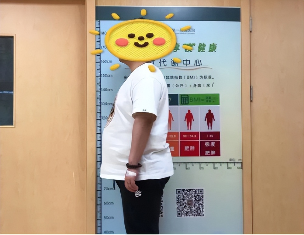 男子“胖”不堪言 医生手术“缩胃”帮助减重