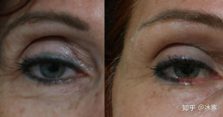 南京黑眼圈门诊开诊1年：一号难求的背后原因揭晓