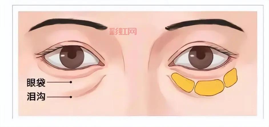 南京黑眼圈门诊开诊1年：一号难求的背后原因揭晓