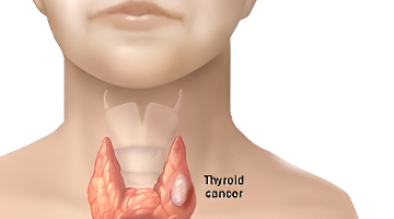 张若昀推娃车被偶遇，唐艺昕优雅辣妈形象，夫妻同心打破离婚传闻