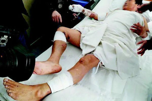 鞍山一小区夜晚窜进野猪吓坏居民 大连曾发生野猪袭人致死