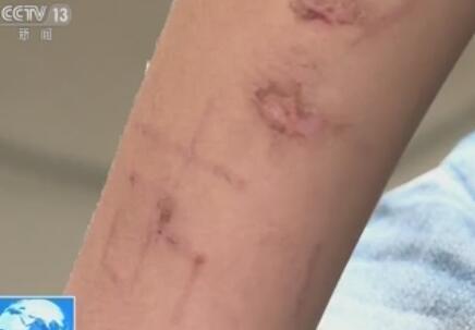 “蓝鲸”死亡游戏传入中国 家长需提高警惕