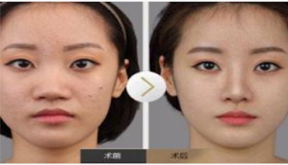 百度移动APP落地页体验白皮书解读