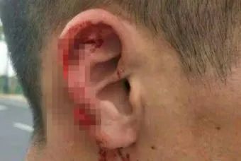 近期“碰瓷儿”高发!遇到就报警