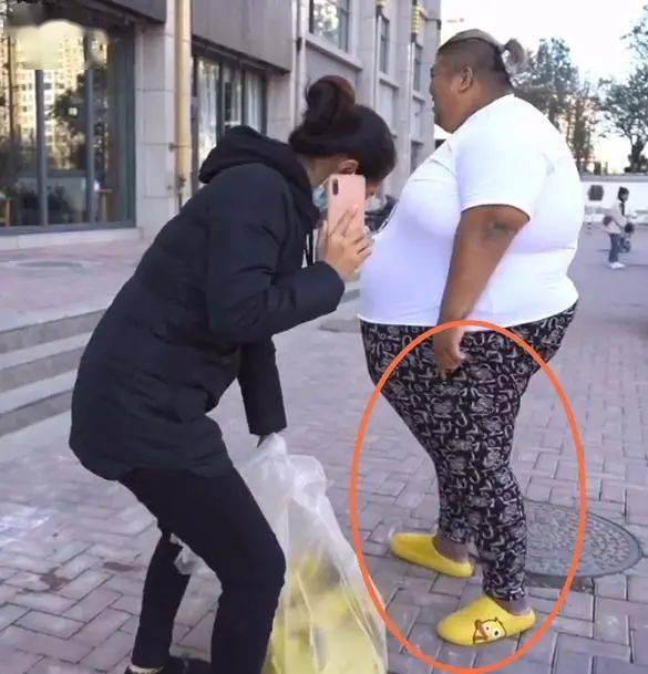 “泡泡龙悲剧”再上演？千万网红小贝近况曝光，皮肤无光泽发量少