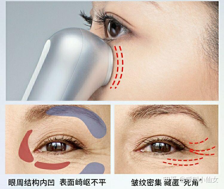 2025全线亲测！雅萌美容仪器怎么样？雅萌ACE六代闪修仪DEEP和max三代哪款好？日本雅萌真的有用吗？有效果吗？到底有没有用？是智商税吗？绿光面罩哪个型号好？和极萌有哪些区别？Yaman好用吗？