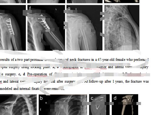 揭秘地下“论文工厂”：价格几千元至数万元，代写代发“一条龙”