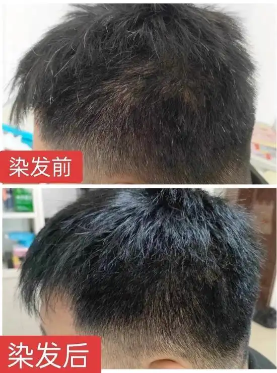 黑色染发剂哪个牌子最好最安全？家用无刺激自然黑染发剂推荐，2026安全遮白黑染品牌精选