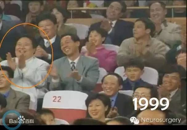 霸屏春晚19年的“笑脸哥”，今年没见着？原来……