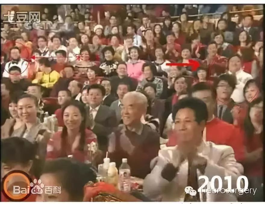 霸屏春晚19年的“笑脸哥”，今年没见着？原来……
