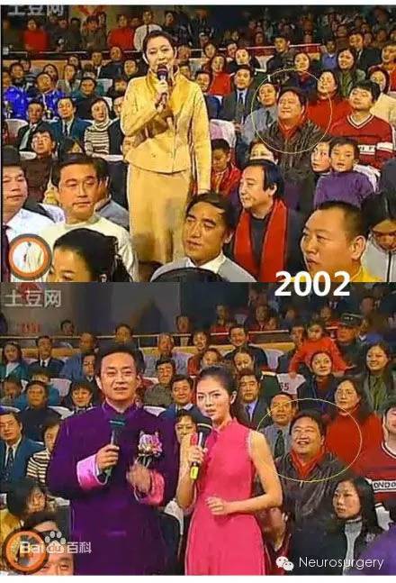 霸屏春晚19年的“笑脸哥”，今年没见着？原来……