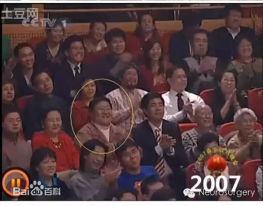 霸屏春晚19年的“笑脸哥”，今年没见着？原来……