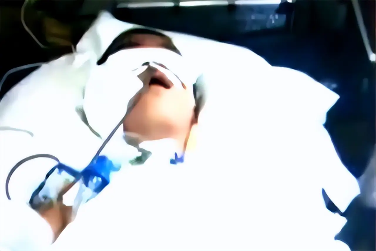 2012年，山东13岁男孩遭高压泵充气，内脏20处穿孔，医生无能为力