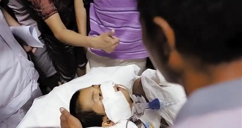 12岁山东男孩遭工友恶作剧，高压泵灌气致五脏重创！