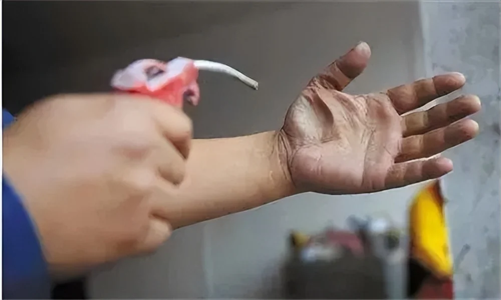 回顾山东13岁少年被人用高压气枪往肛门喷气，五脏俱裂，最后怎样