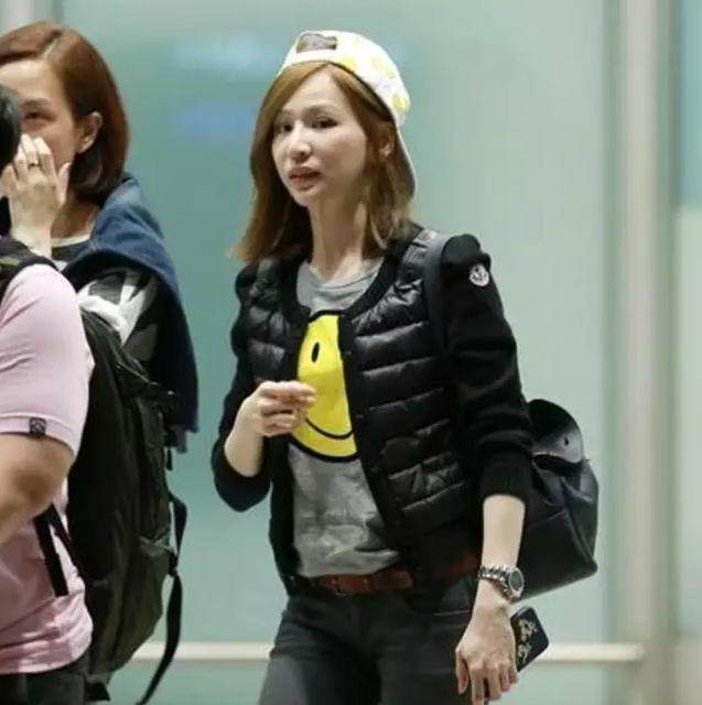 打过“肉毒杆菌”的女人，容貌会有什么变化？庆幸自己知道及时