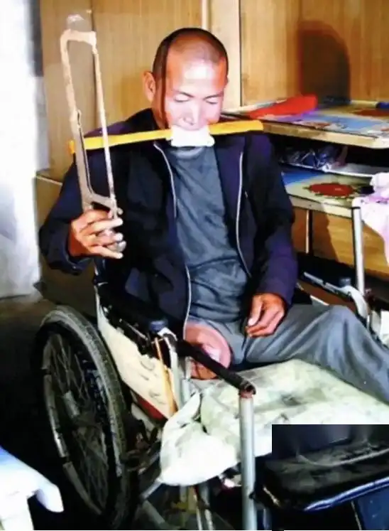 男子因无力支付手术费，自锯双腿，12年后现状如何？