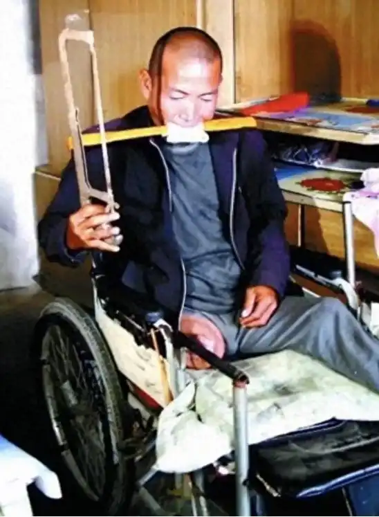 河北男子拿不出100万手术费，回家自己锯掉双腿，12年过去怎样了