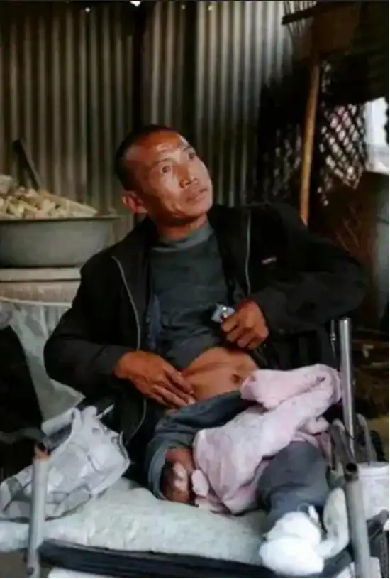 河北男子拿不出100万手术费，回家自己锯掉双腿，12年过去怎样了