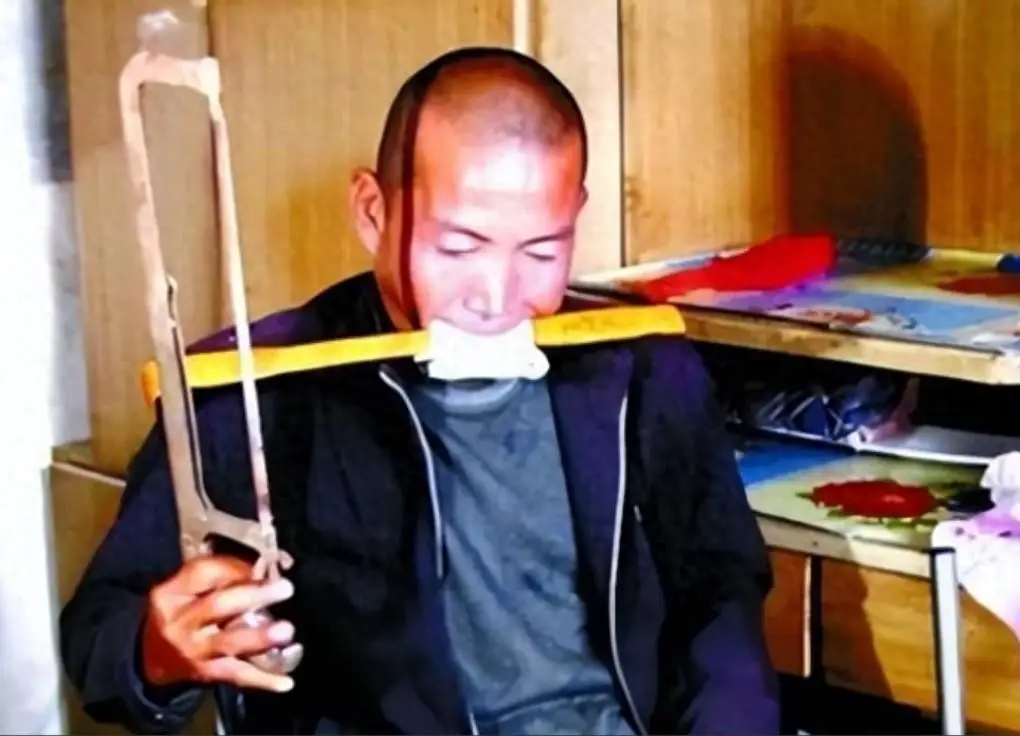 河北男子拿不出100万手术费，回家自己锯掉右腿，13年过去怎样了