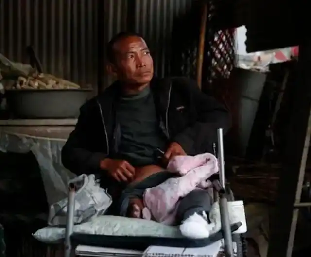 河北男子拿不出100万手术费，回家自己锯掉右腿，12年过去怎样了