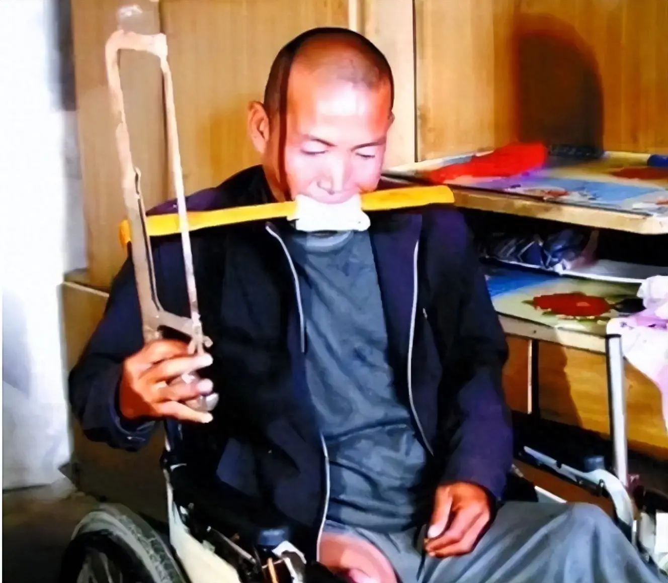 河北男子拿不出100万手术费，回家自己锯掉右腿，12年过去怎样了