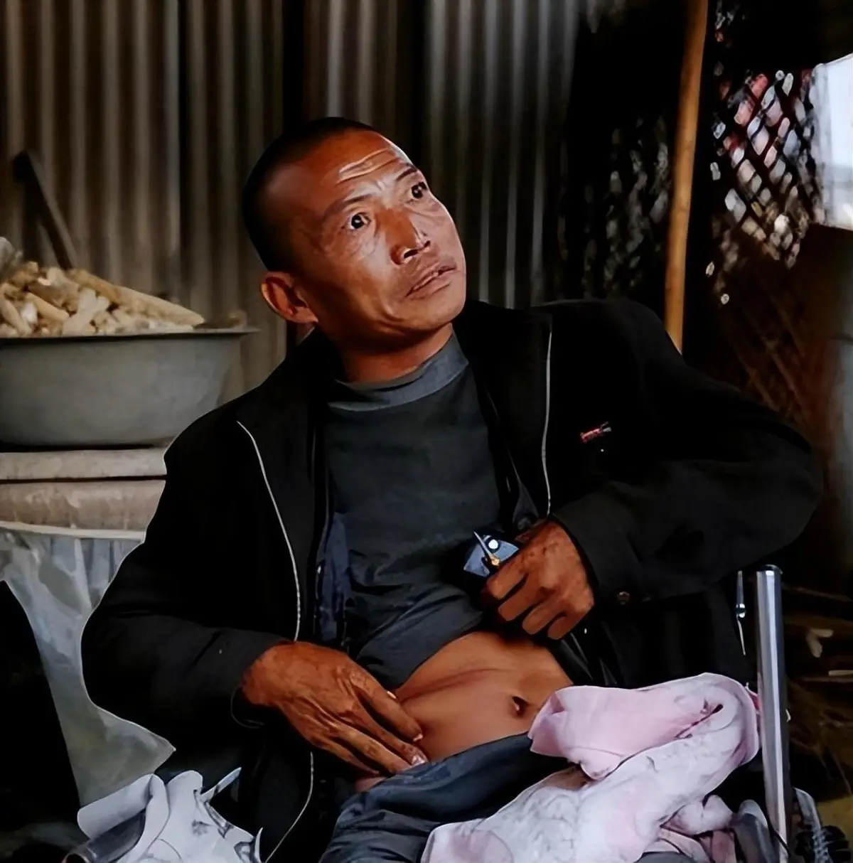 河北男子拿不出100万手术费，回家自己锯掉右腿，12年过去怎样了