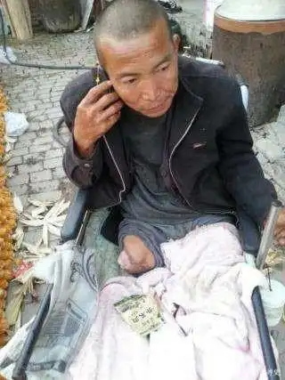 纪实：男人可以多坚强？为节省百万医疗费，自己忍痛锯断右腿求生