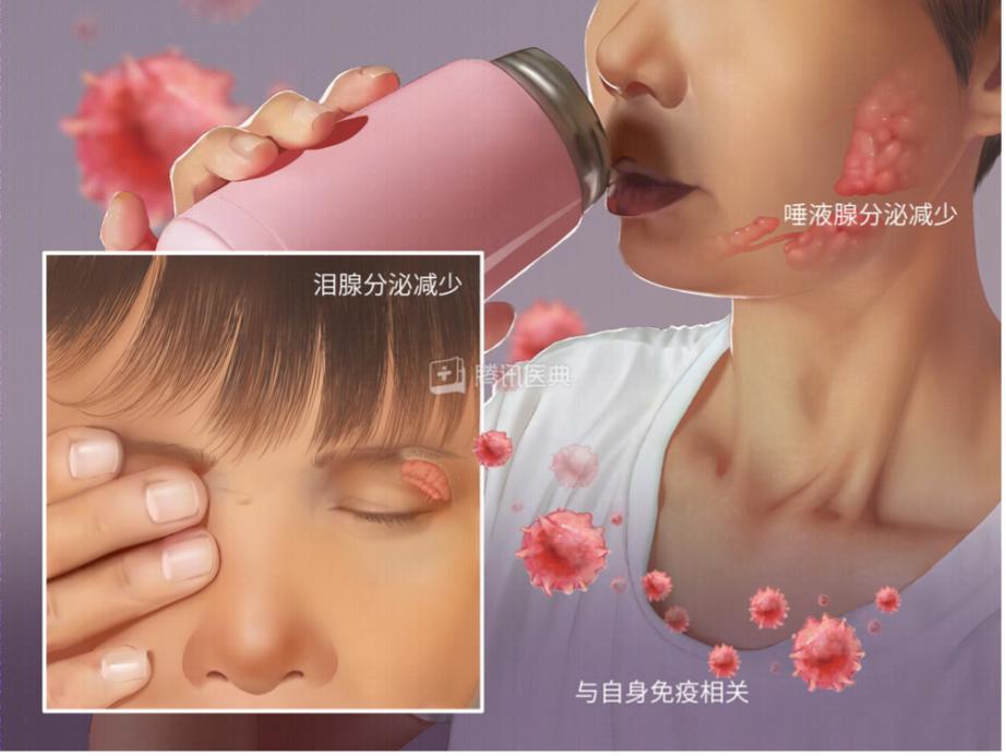 总是口干，喝水也不管用，警惕这些病找上门