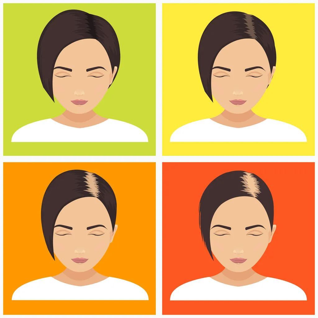 原来这种“发际线”问题可自愈,早点知道就好了