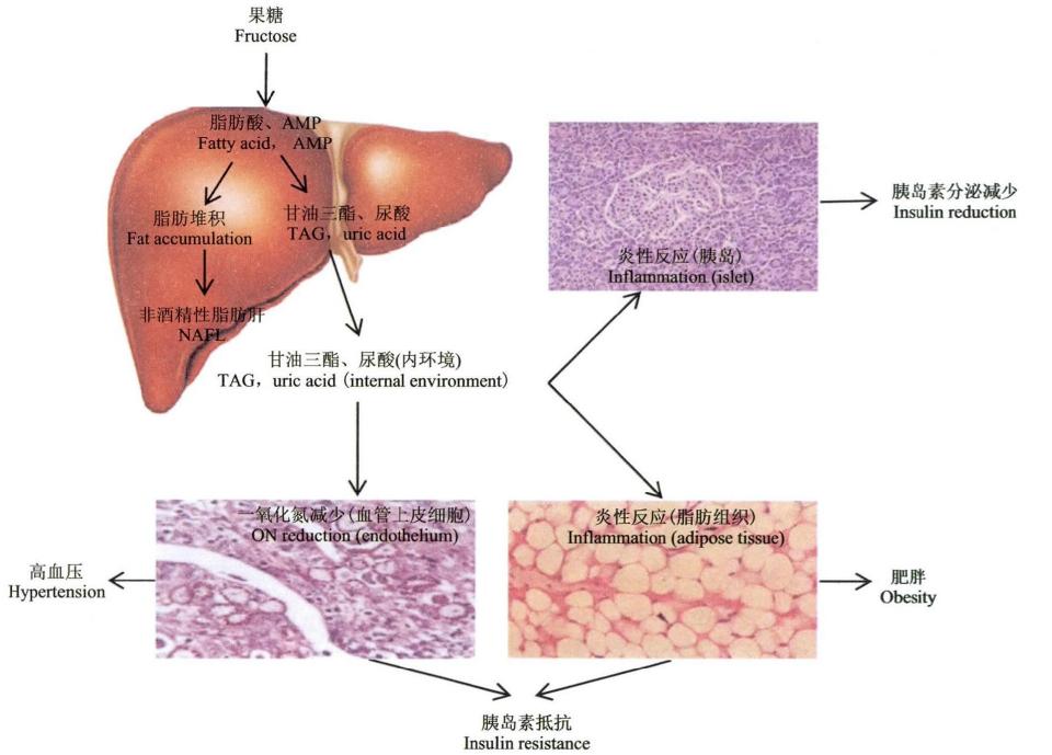 雪碧偷偷换了配方？从化工厂走出来的果葡糖浆，真的是“健康杀手”吗？
