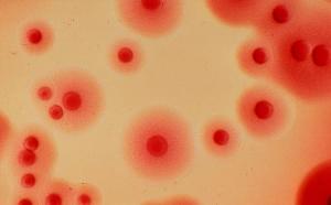 16家知名快餐业被点名,中国养殖业该不该禁用抗生素?