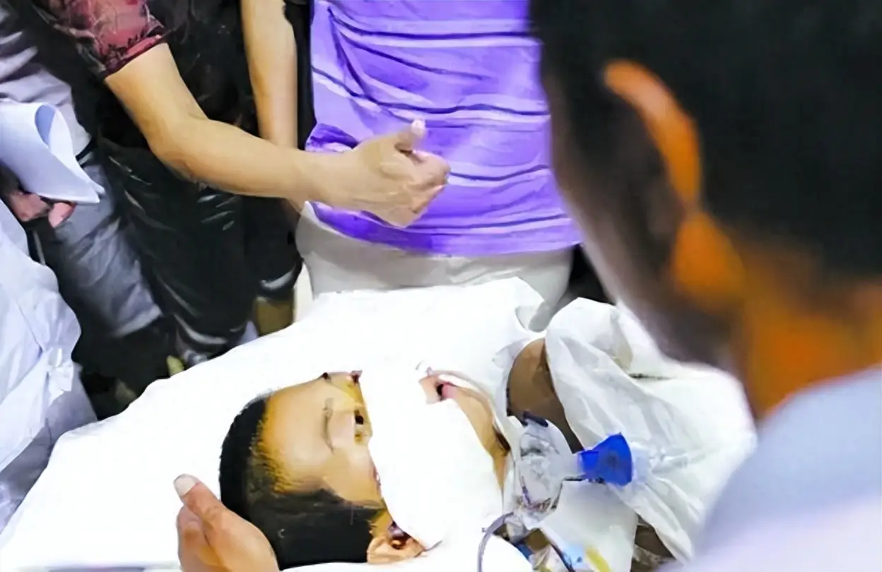 10年前山东男孩被高压泵体内充气,内脏严重损坏,工友赔偿112万