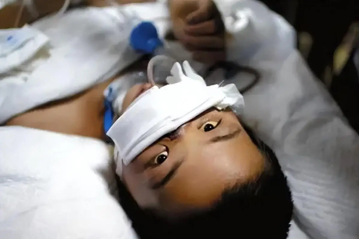 12年，山东男孩被工友开玩笑，用高压泵往体内充气，五脏严重损坏