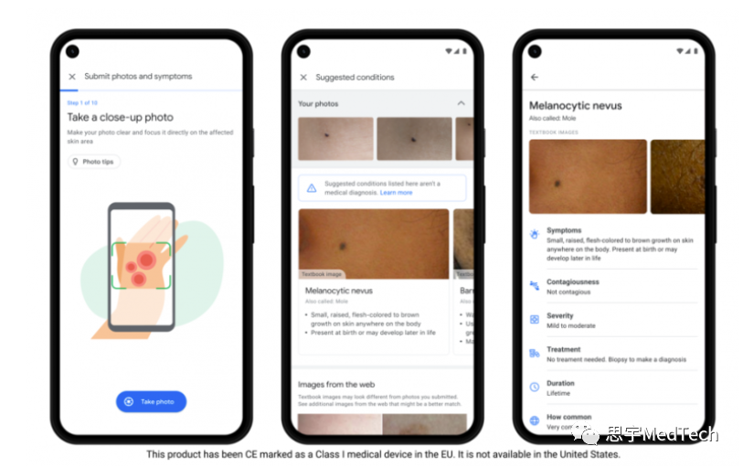 从风花雪月到柴米油盐，盘点23家医疗AI海外公司在疾病诊断、智能阅片、优化医院管理的应用